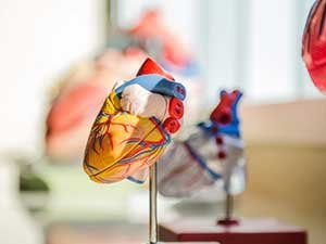 Interventional Cardiology Procedures
